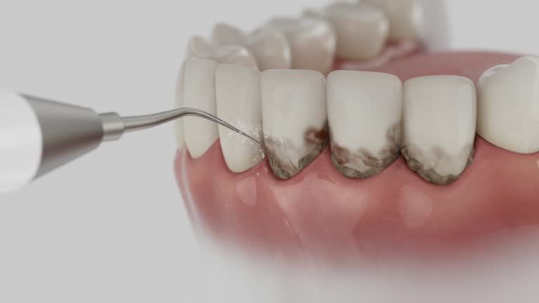 Reliable Dental Implants contractor in Lockwood, MO by Smile Center Dentistry